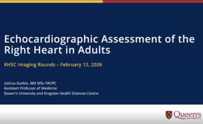 Echocardiographic Assessment of the Right Heart in Adults thumbnail