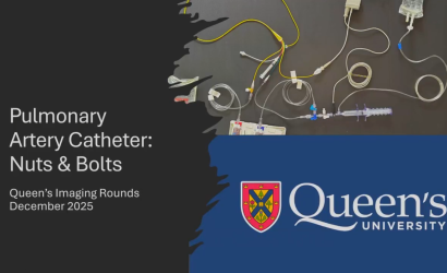 Pulmonary Artery Catheter: Nuts & Bolts